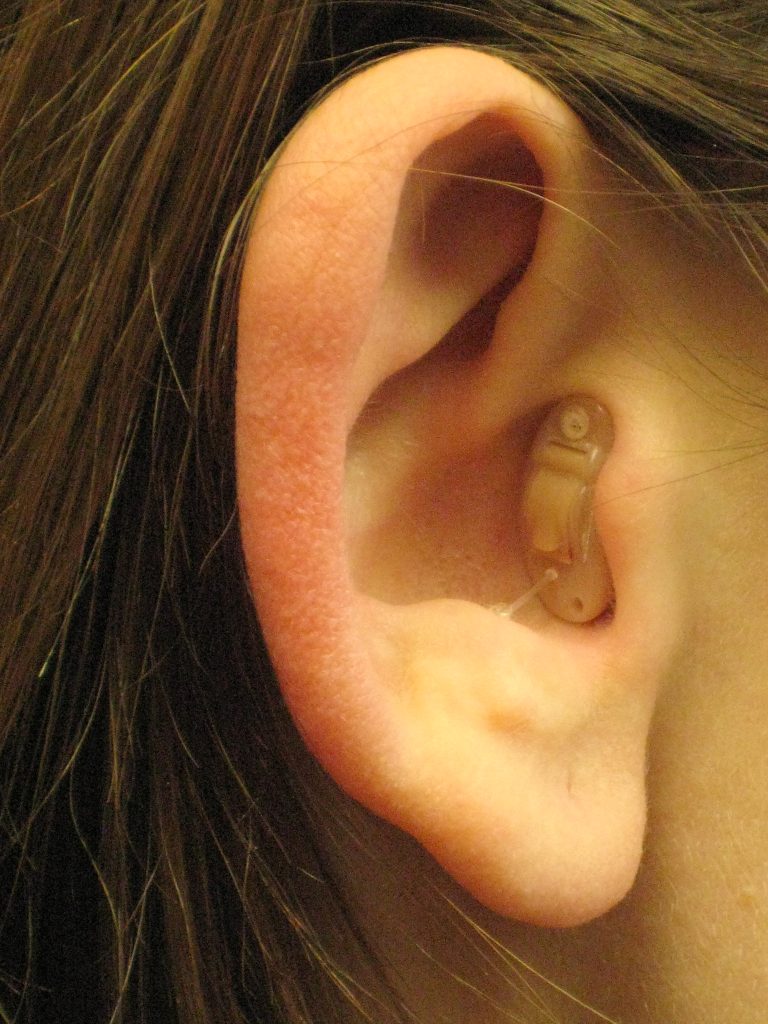 Completely in the Canal (CIC) Hearing Aid