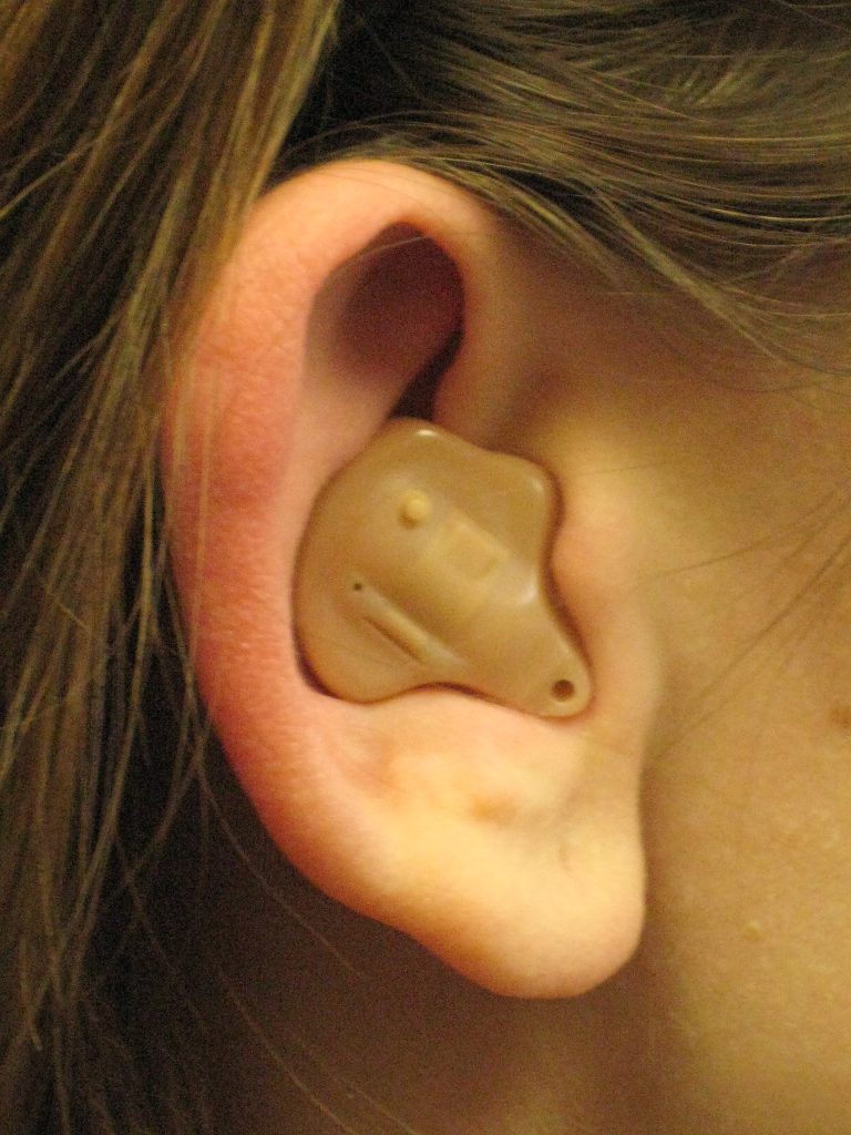 In the Ear (ITE) Hearing Aid